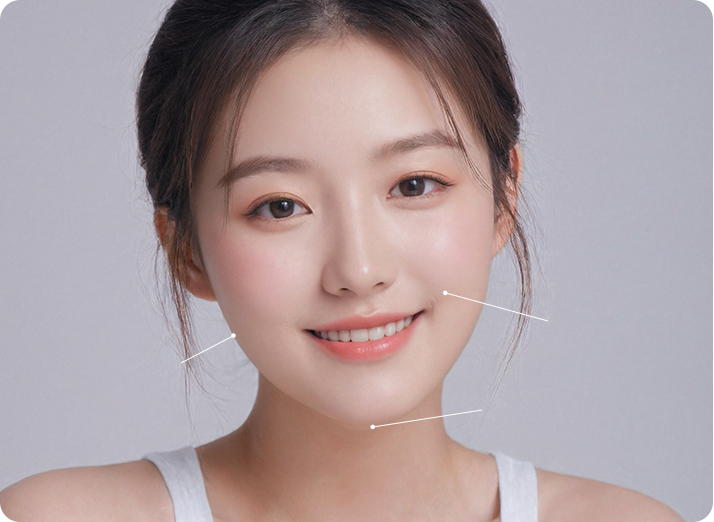부산 서면 튠라이너 얼굴 라인 개선 부위