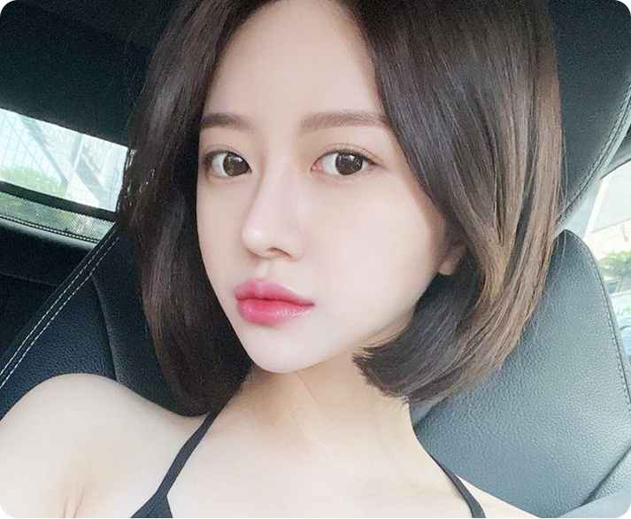 부산 서면 올리지오X 리프팅 시술 대상 및 얼굴 탄력 개선