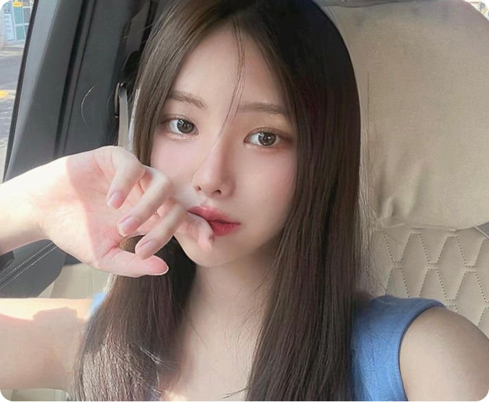 부산 DCM 시술 대상 피부결 개선 광채 효과